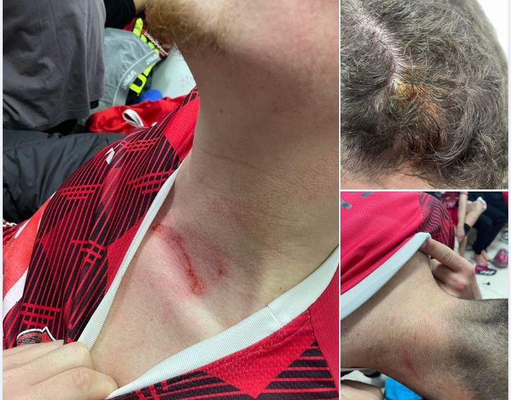 Futbollistët e Lepencit lëndohen nga tifozët pas ndeshjes me Sharrin