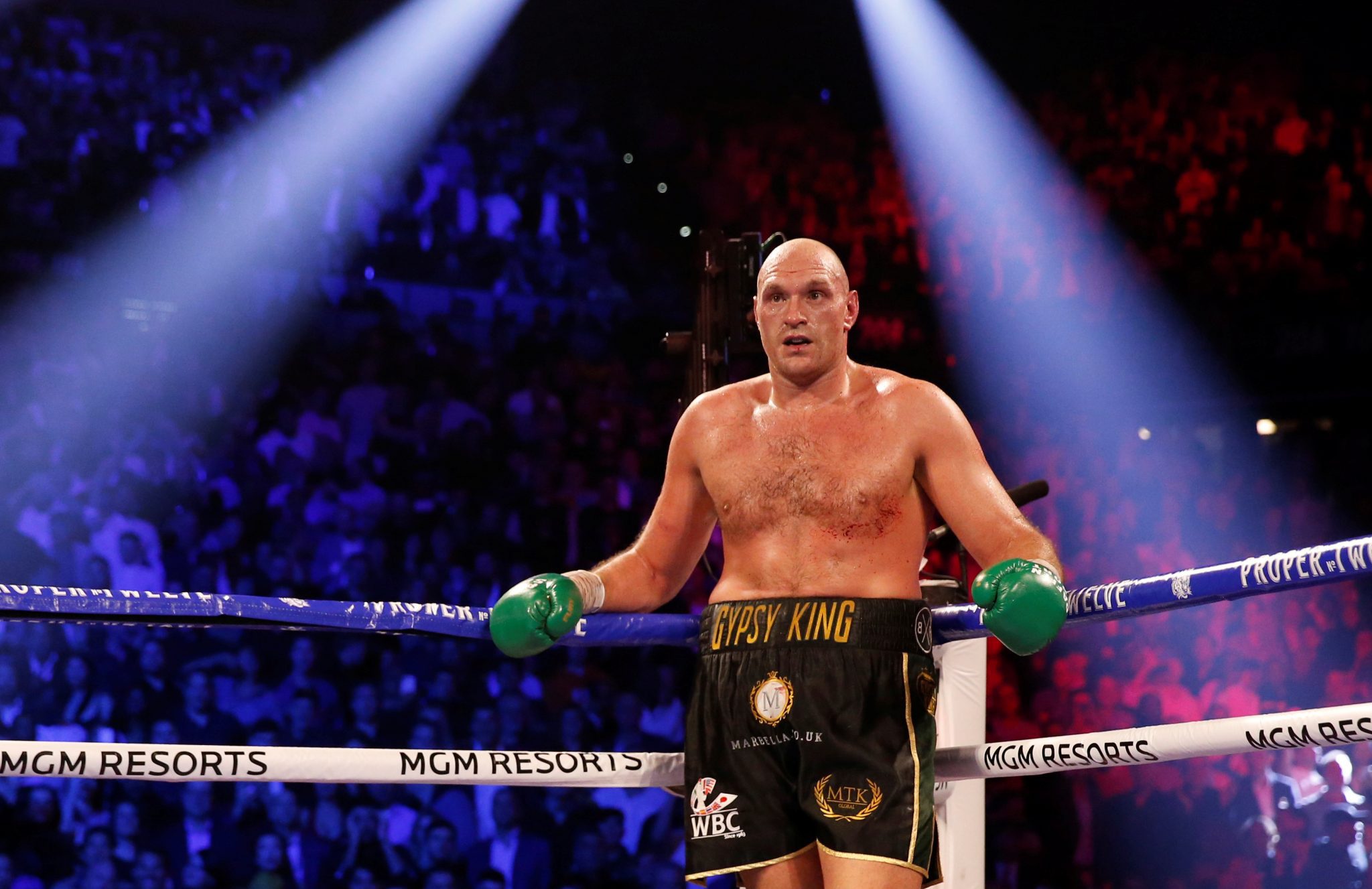 Tyson Fury: Nëse fitojë ndaj Oleksandr Usyk, atëherë do jem boksieri më i mirë i të gjitha kohërave në peshat e rënda