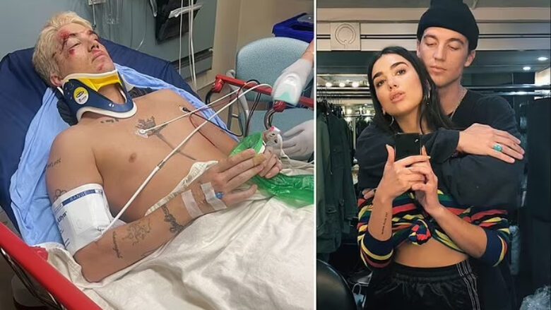 Ish-i dashuri i Dua Lipës, përfundon në spital pas një aksidenti të rëndë me veturë