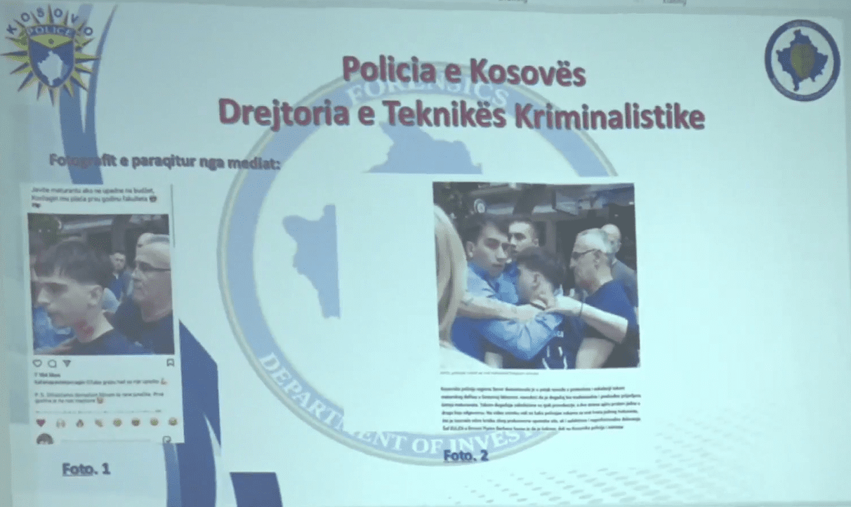 Policia për incidentin në veri: Maturanti kishte ngjyrë në qafë, jo gjak