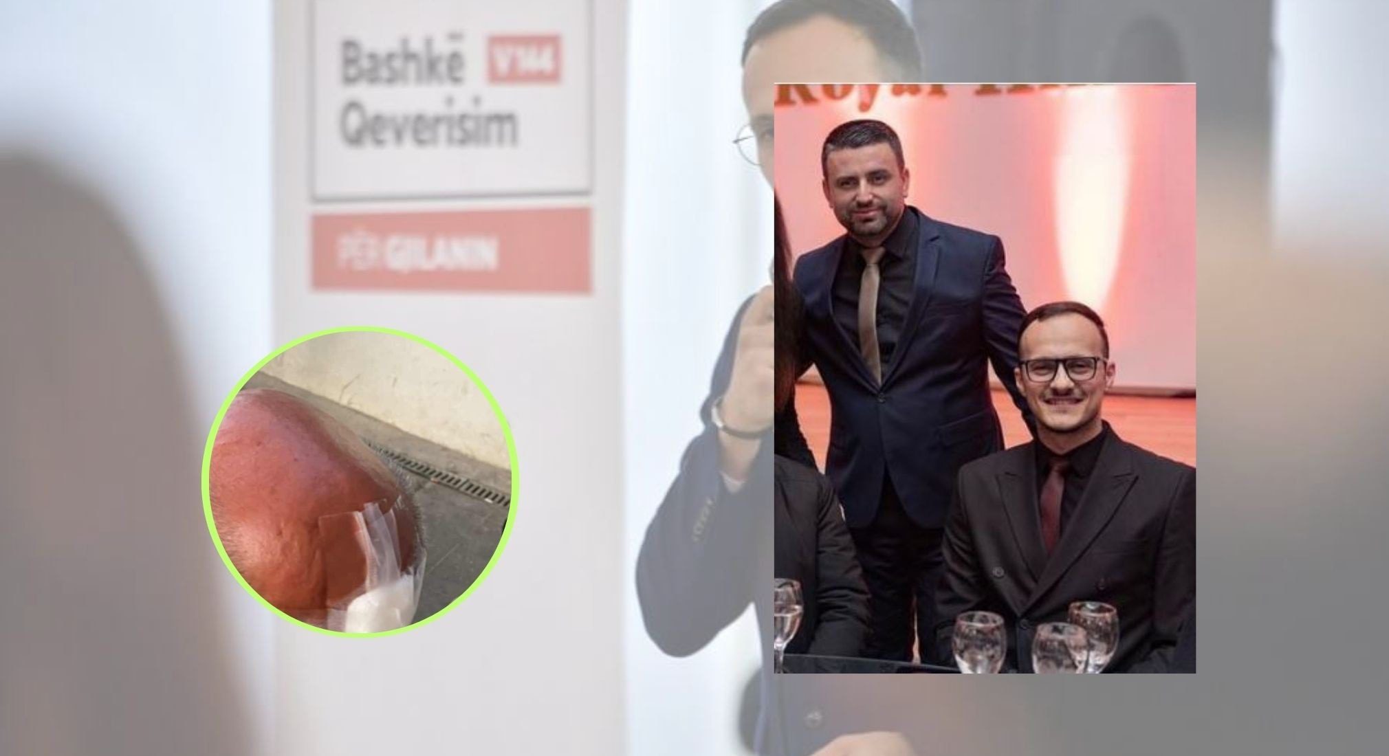 U raportua se u përfshi në një përleshje, pezullohet nga detyra shefi i kabinetit të Hysenit