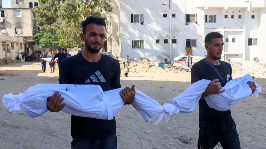 Gaza: Operacione pa anestezi, Izraeli afrohet te spitali al-Shifa