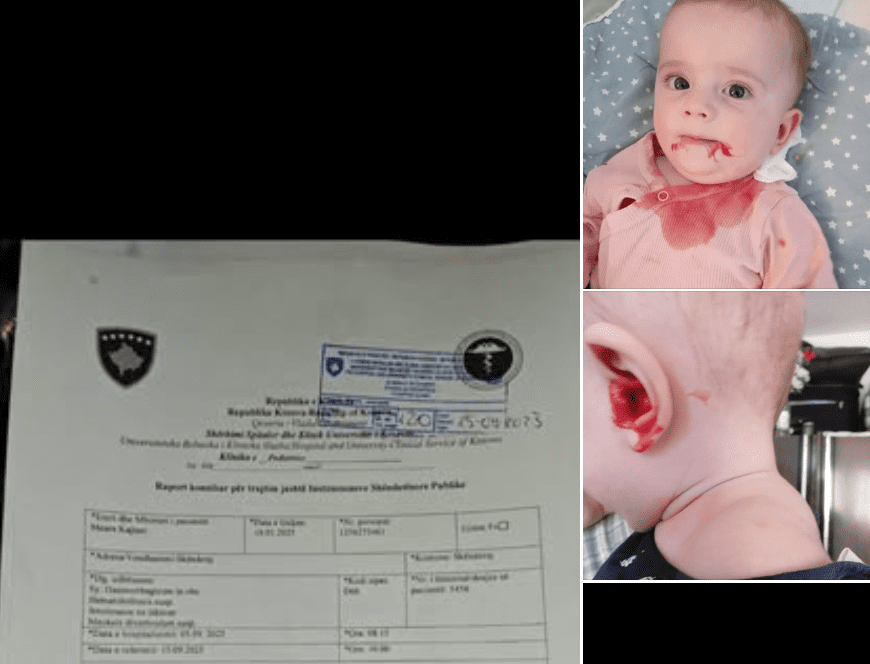 Foshnja Meara Kajtazi ka nevojë urgjente për trajtim jashtë Kosovës: Familja kërkon ndihmë
