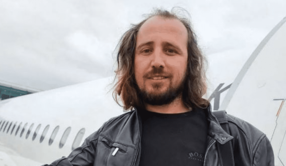 Shqiptari vdes në Turqi pasi mbolli flokët dhe rregulloi dhëmbët