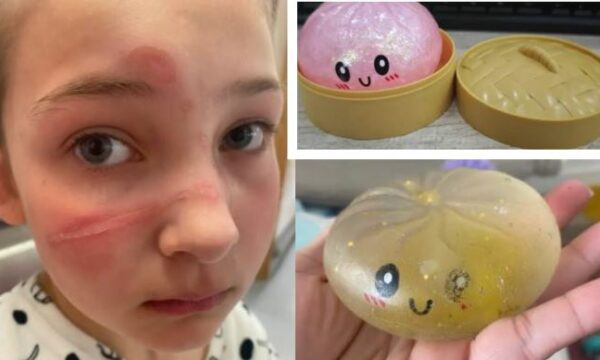 New York Post: Alarmi për lodrat e njohura “Squishy”, rrezik për lëndime serioze