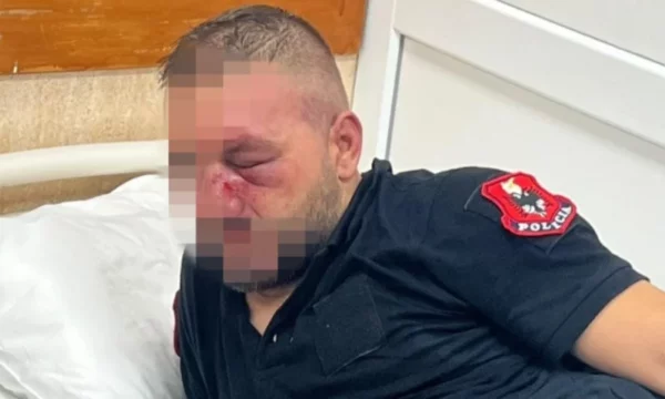 Trazirat në rrugët e Tiranës, 14 policë të lënduar, 35 protestues janë shoqëruar në stacion