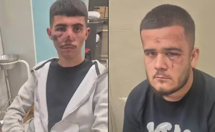 Ngjarje e rëndë në Shkup, dy të rinj dyshohet se u rrahën brutalisht nga Policia